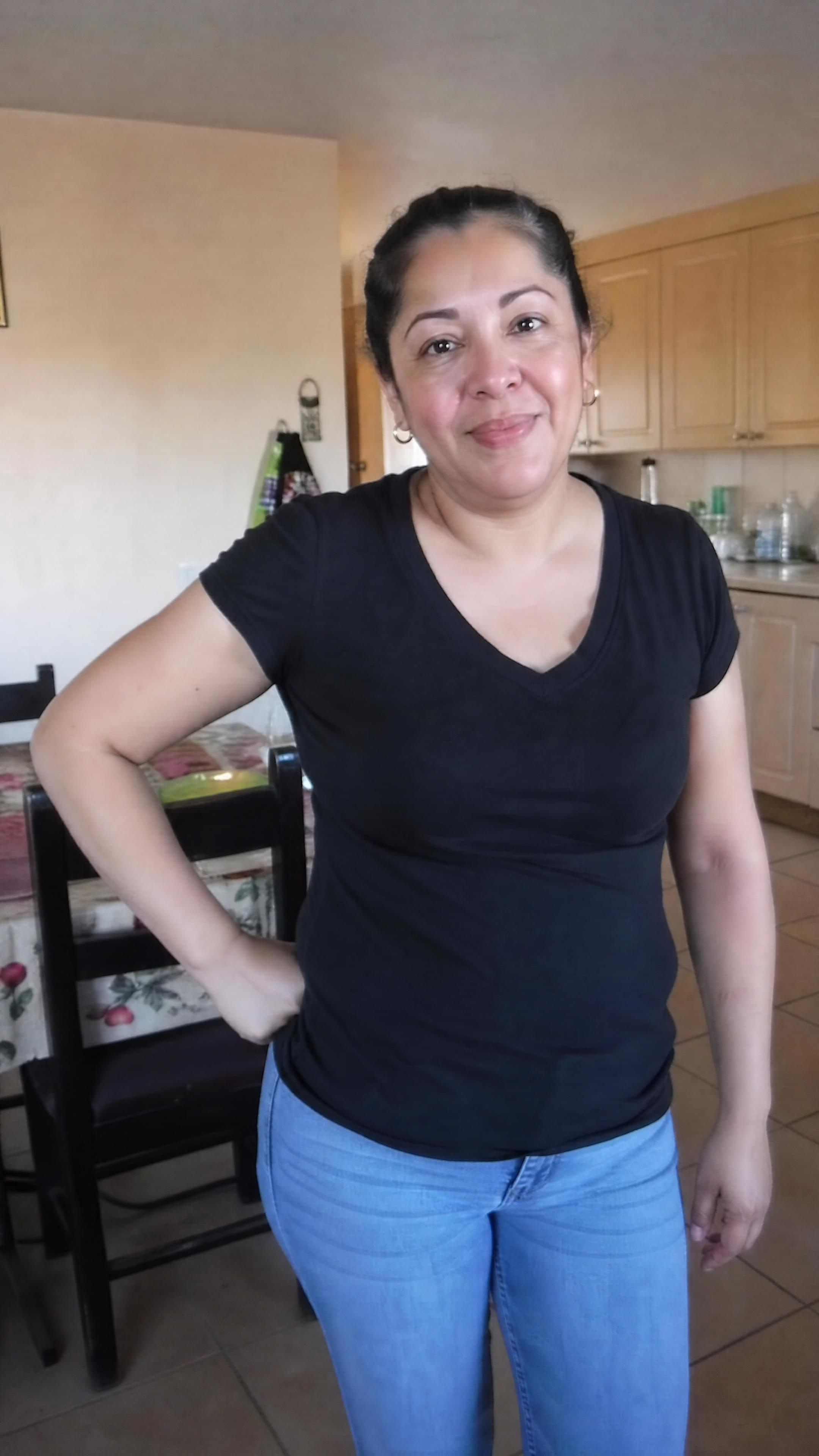 Ana T., caso Resistencia insulina